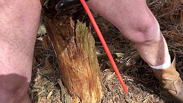 Outdoor neon catheter insertion